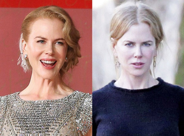 Nikol Kidman