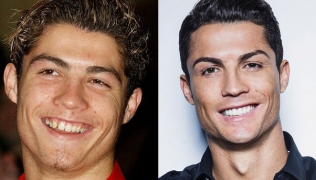 Qizqiqarli ma’lumot: Krishtianu Ronalduning yillar davomida o’zgargan tashqi ko’rinishi