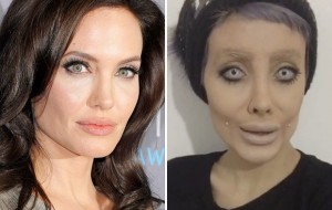 Eronlik qiz Anjelina Joliga o’xshash uchun yuzini 50 marta operatsiya qildirdi