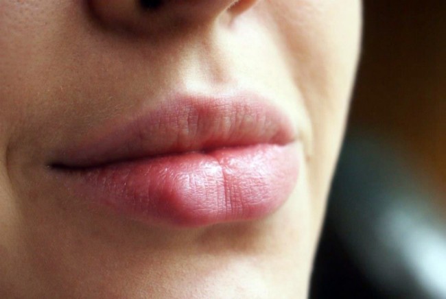 5. Po’stdan tozalovchi vosita