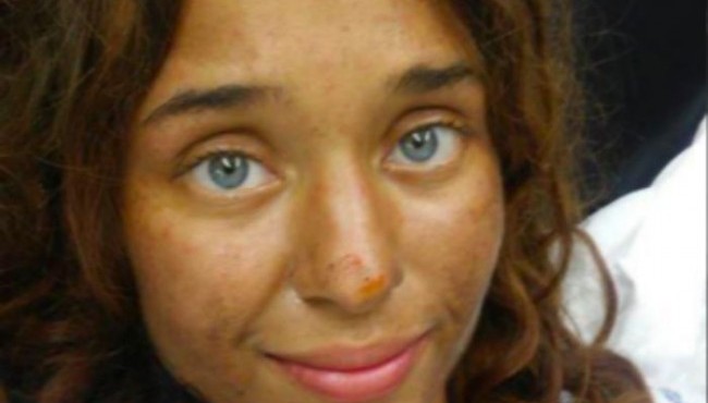 Qiziqarli olam: Yo’qolib qolgan talaba qiz bir oy davomida o’rmonda meva va qo’ziqorinlar yeb yashagan